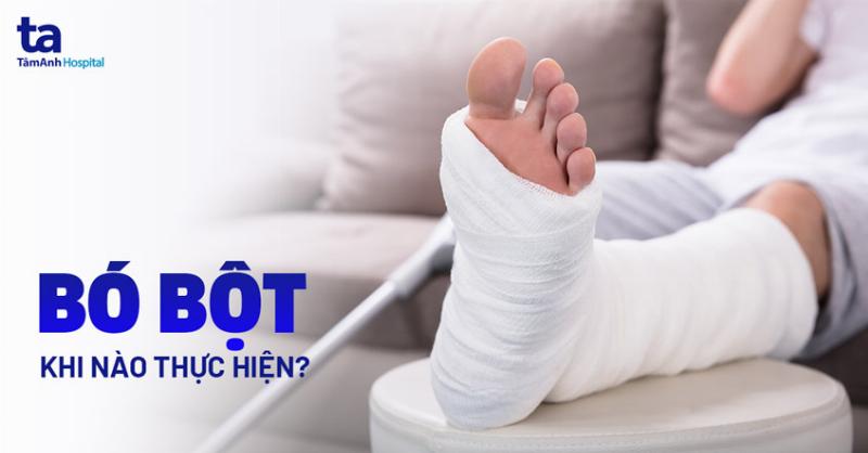 Minh hoa cac phuong phap dieu tri gay xuong cang chan pho bien, bao gom bo bot va phau thuat ket hop xuong trong benh an